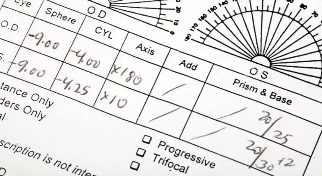 Các ký hiệu thường gặp trên phiếu đo mắt