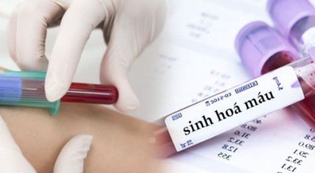 Không phải tất cả các trường hợp khám mắt đều cần xét nghiệm máu