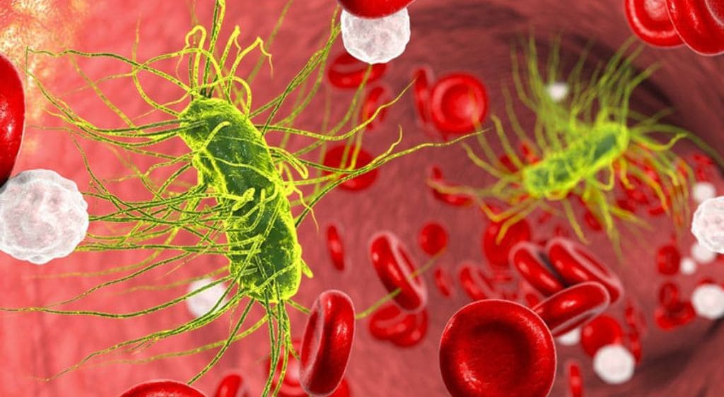 Nhiễm trùng huyết là một biến chứng nguy hiểm, tỉ lệ tử vong rất cao