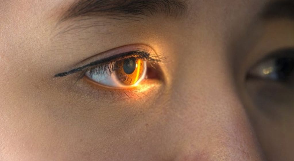 Soi bóng đồng tử trong quy trình khám mắt chuyên sâu