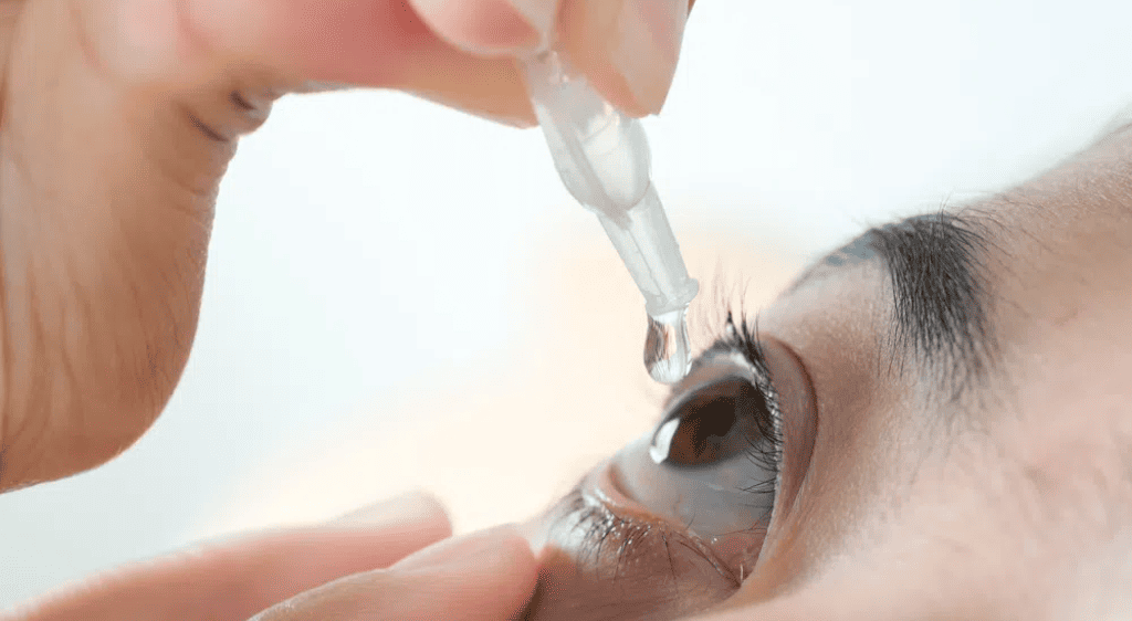 Sử dụng nước mắt nhân tạo hỗ trợ quá trình hồi phục tự nhiên của mắt