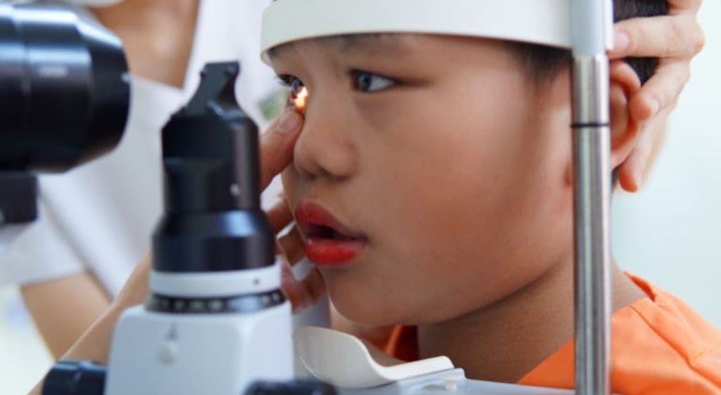 Trẻ em sẽ được ưu tiên phương pháp khám mắt soi bóng đồng tử và nhỏ thuốc liệt điều tiết để đo độ cận