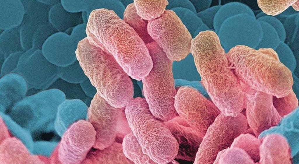 Vi khuẩn Staphylococci là chủng phổ biến nhất gây viêm mí mắt ở trẻ