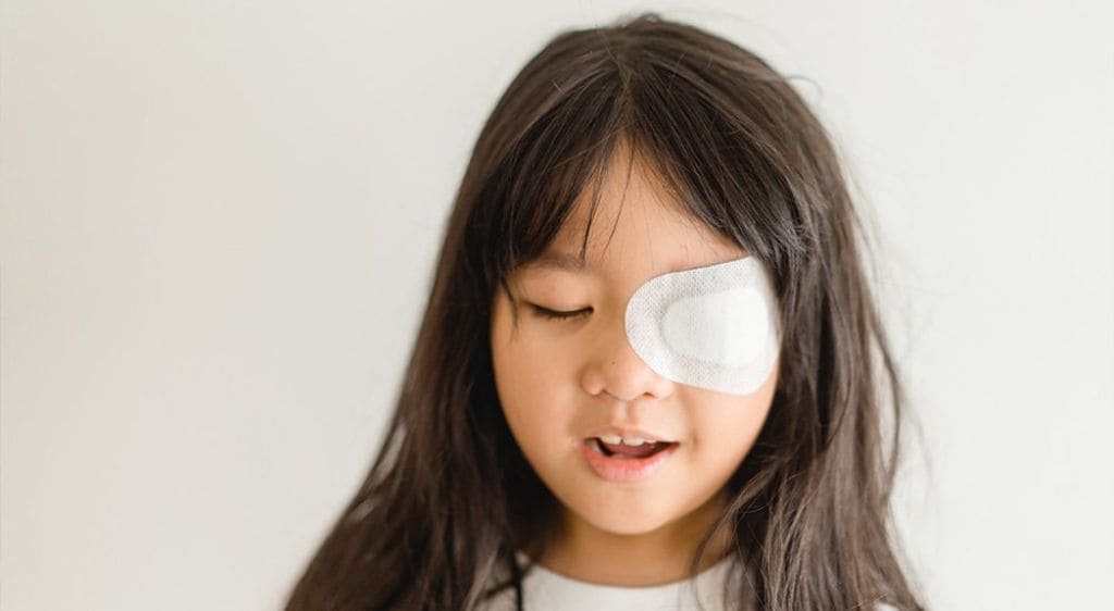 Che mắt là phương pháp điều trị nhược thị khi không mổ được