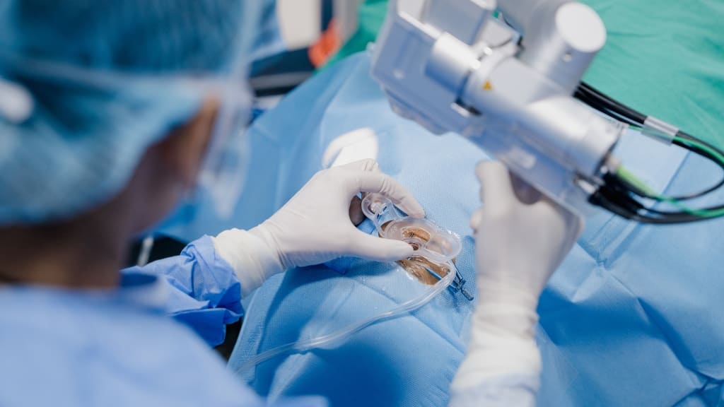 Ghép giác mạc có tỉ lệ thành công cao