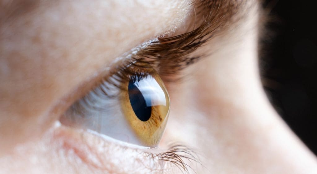 Giác mạc hình chóp là một trong những bệnh lý thường gặp của giác mạc