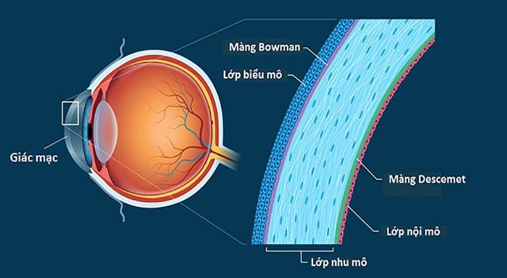 Giác mạc là một mô trong suốt, có cấu trúc nhiều lớp, nằm ở phía trước nhãn cầu