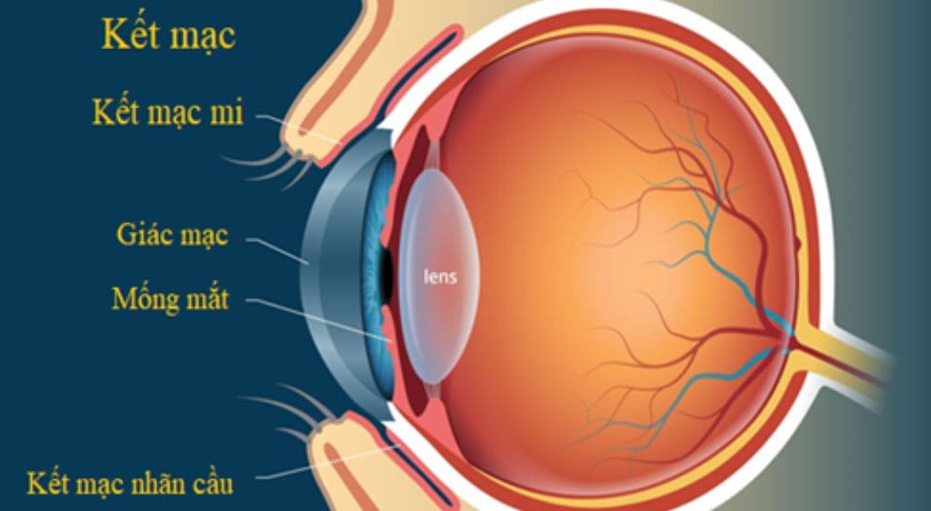 Hình ảnh giải phẫu của kết mạc và giác mạc ở trong mắt