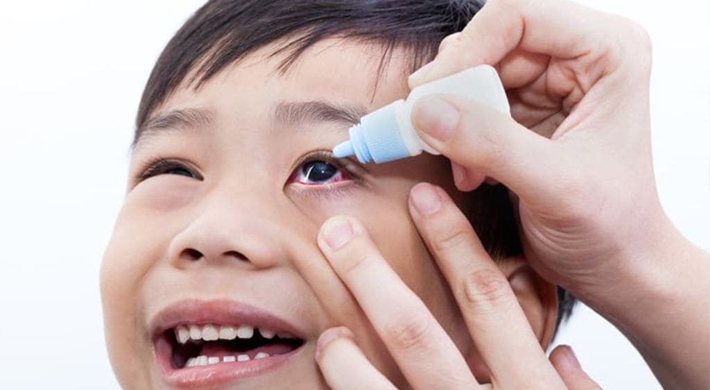 Không tự ý nhỏ thuốc chứa Corticoid cho trẻ nếu chưa có chỉ định từ bác sĩ