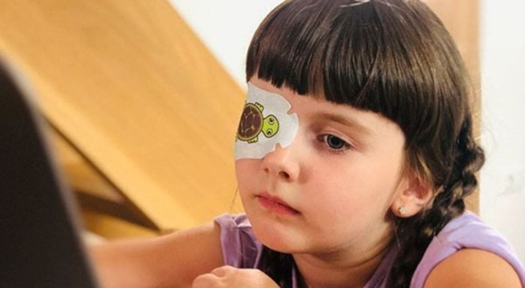 Nhược thị một mắt ở trẻ em