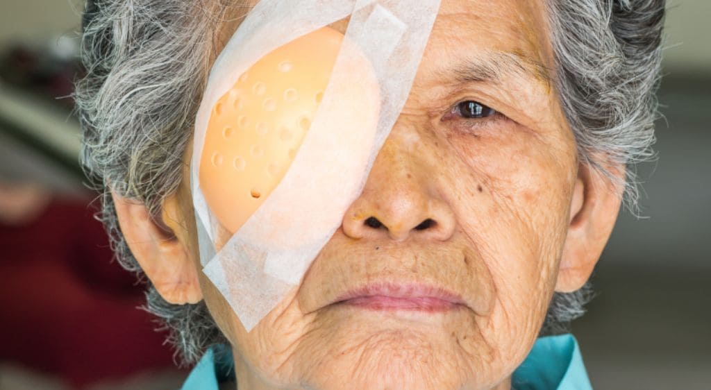 Ở người cao tuổi, quá trình phục hồi giác mạc thường diễn ra chậm hơn