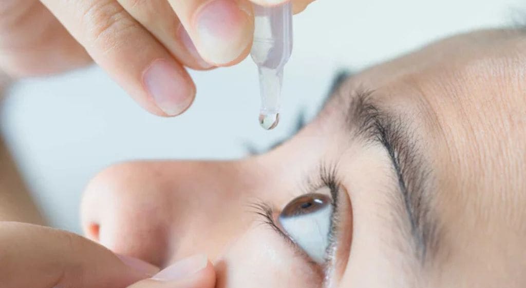 Sử dụng thuốc kháng sinh, kháng viêm nhỏ mắt theo chỉ định bác sĩ giúp nhanh hồi phục vết mổ