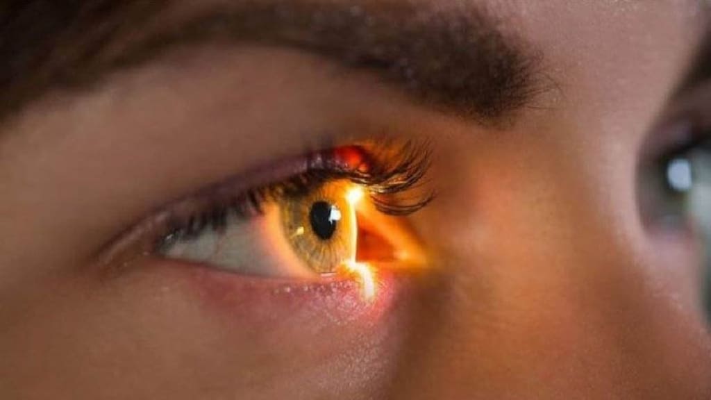 Thiếu Vitamin A có thể gây cả quáng gà và khô mắt, do cùng một nguyên nhân