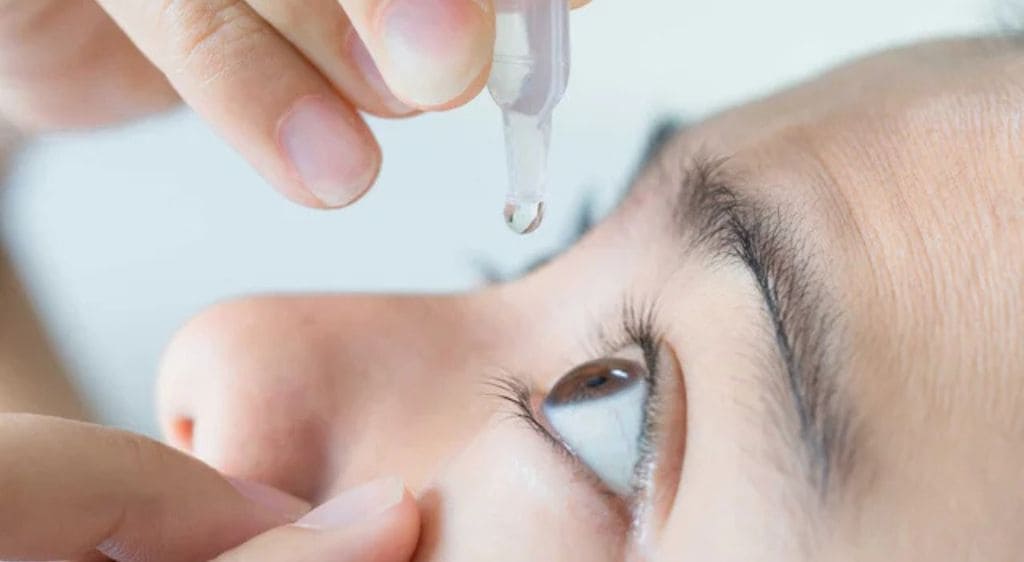 Bác sĩ có thể kê thuốc nhỏ mắt để chứa kháng sinh và kháng viêm để điều trị tắc tuyến lệ