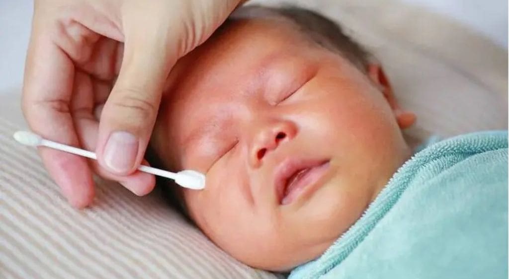 Chăm sóc đúng cách sau khi thông tuyến lệ cho trẻ để đạt hiệu quả tốt nhất