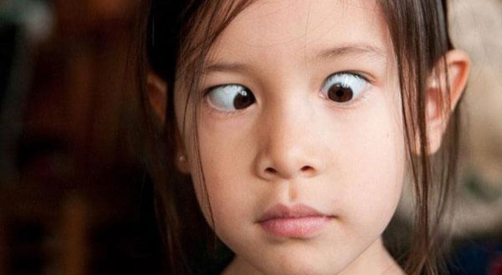 Lác mắt là một trong các nguyên nhân hàng đầu dẫn đến song thị