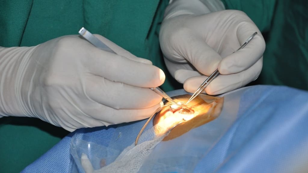 Phẫu thuật loại bỏ nhãn cầu có thể được thực hiện khi nhiễm trùng mắt đã lan rộng