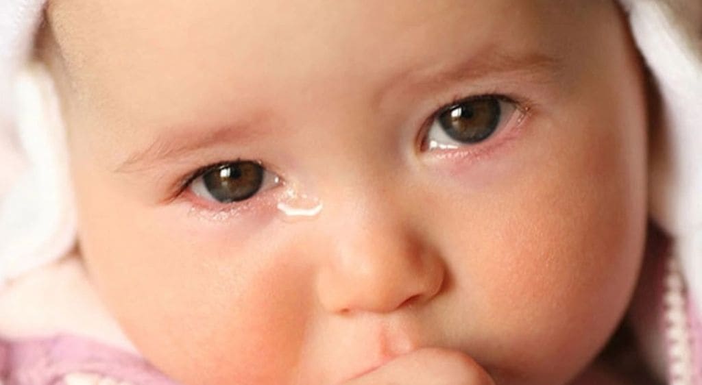 Phẫu thuật tắc tuyến lệ ở trẻ em chi phí cao hơn người lớn