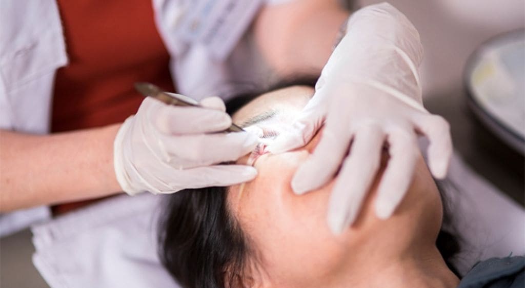 Quy trình nội soi thông tuyến lệ hiện đại, an toàn và thẩm mỹ cao