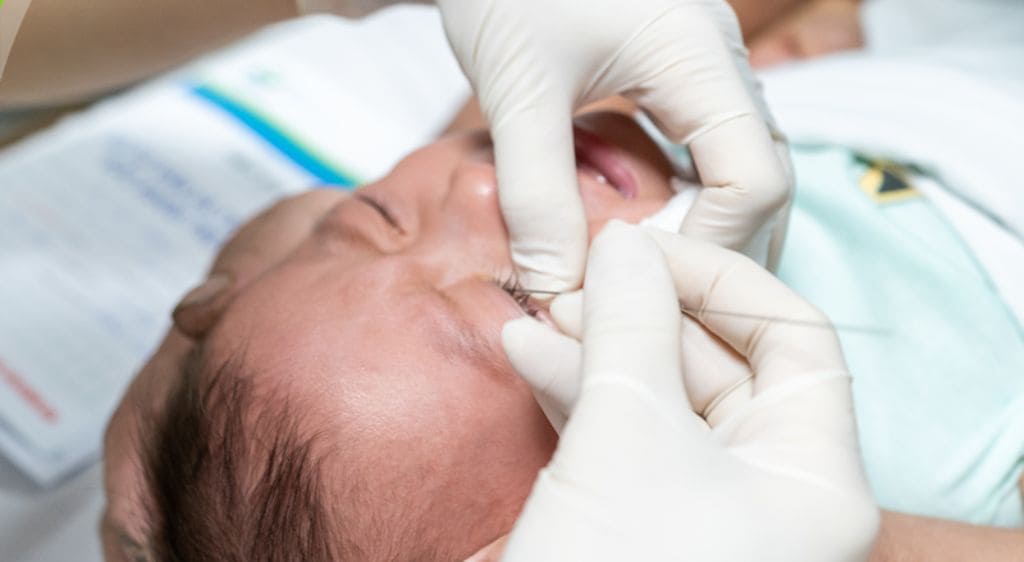 Quy trình thông tuyến lệ ở trẻ sơ sinh diễn ra nhanh chóng, an toàn