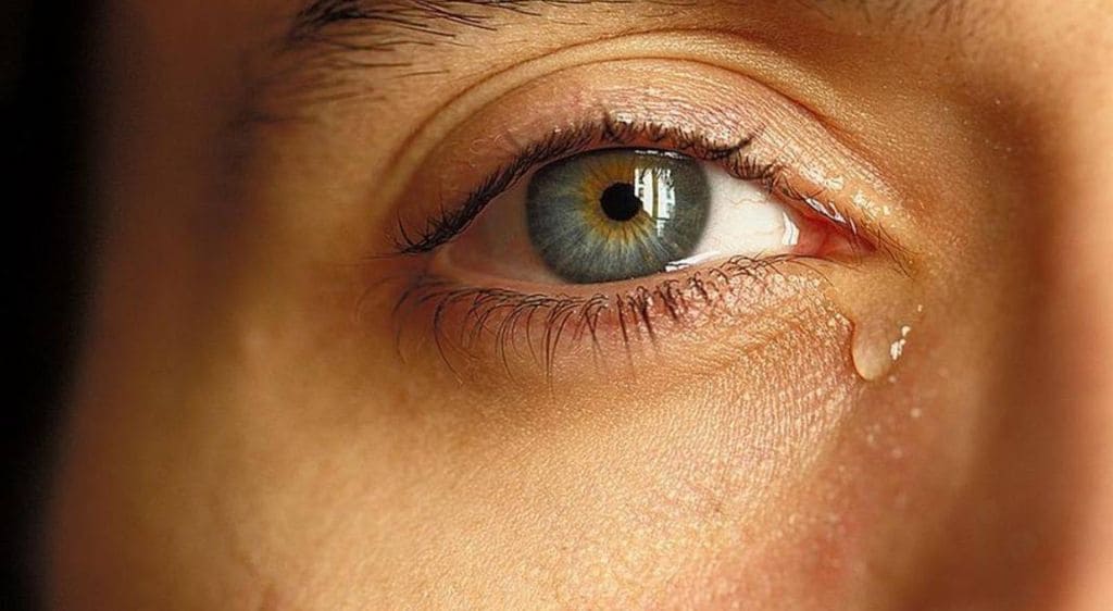 Tắc tuyến lệ gây ra chảy nước mắt sống và làm nhòe tầm nhìn của người bệnh