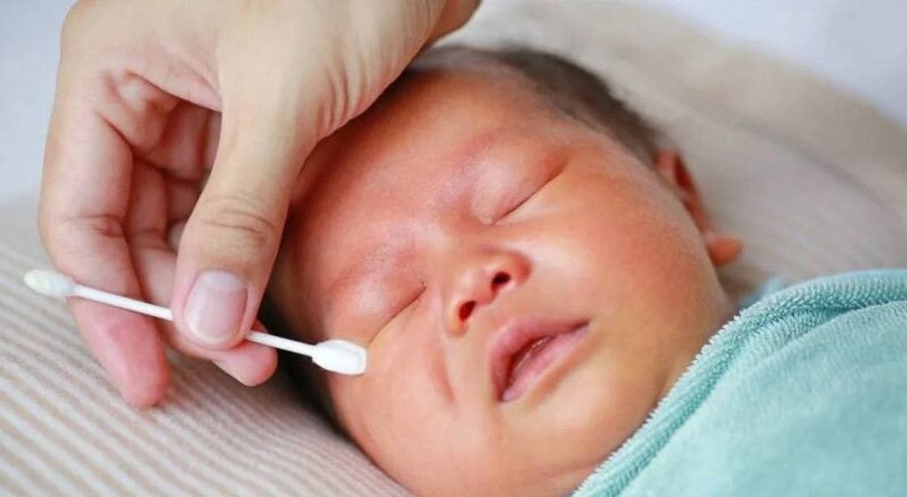 Vệ sinh mắt cho trẻ bằng nước muối sinh lý