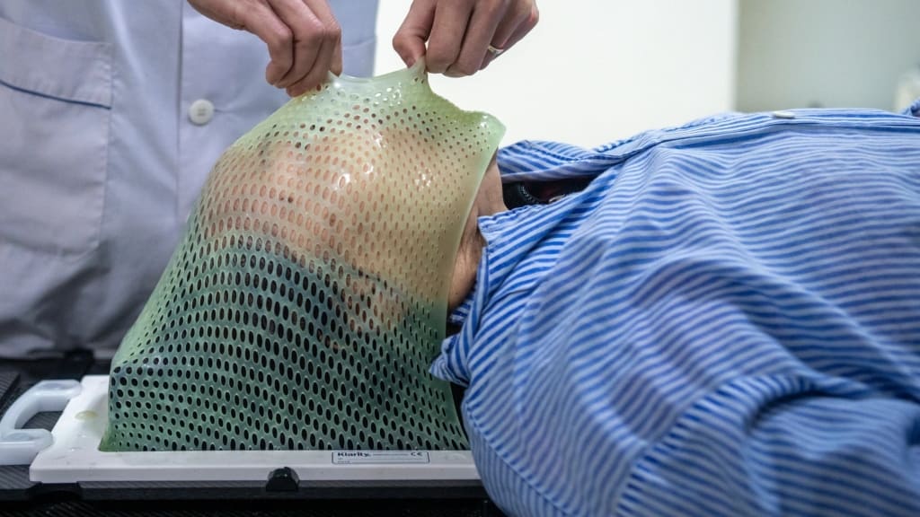 Xạ trị là một trong các phương pháp tiếp cận điều trị u tuyến lệ ác tính