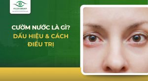 Cườm nước Glaucoma
