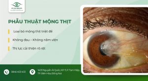 phẫu thuật mộng thịt
