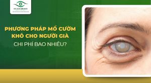 Phương pháp mổ cườm khô cho người già