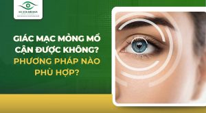 Giác mạc mỏng có mổ cận được không?