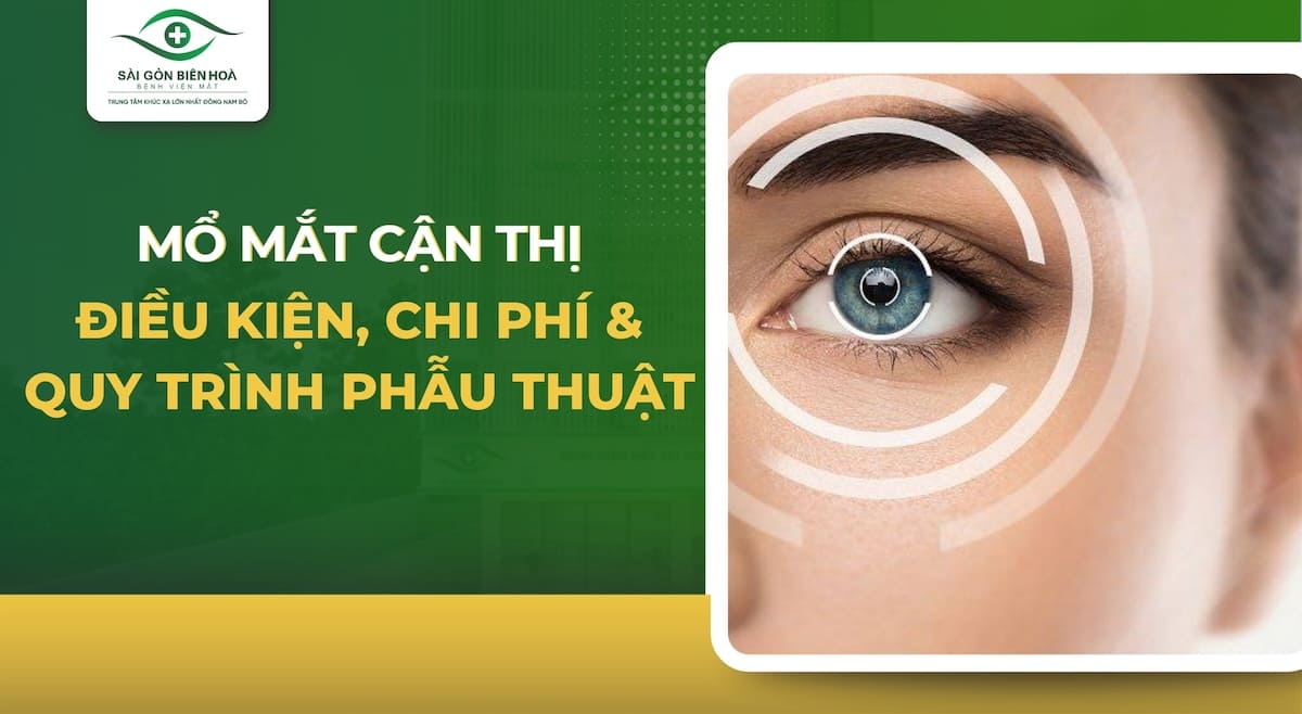 Mổ mắt cận thị