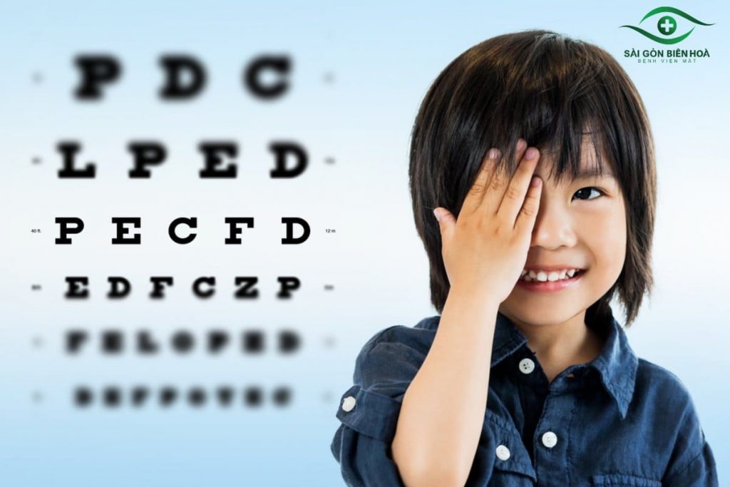 Cận bao nhiêu độ mới bắn mắt được