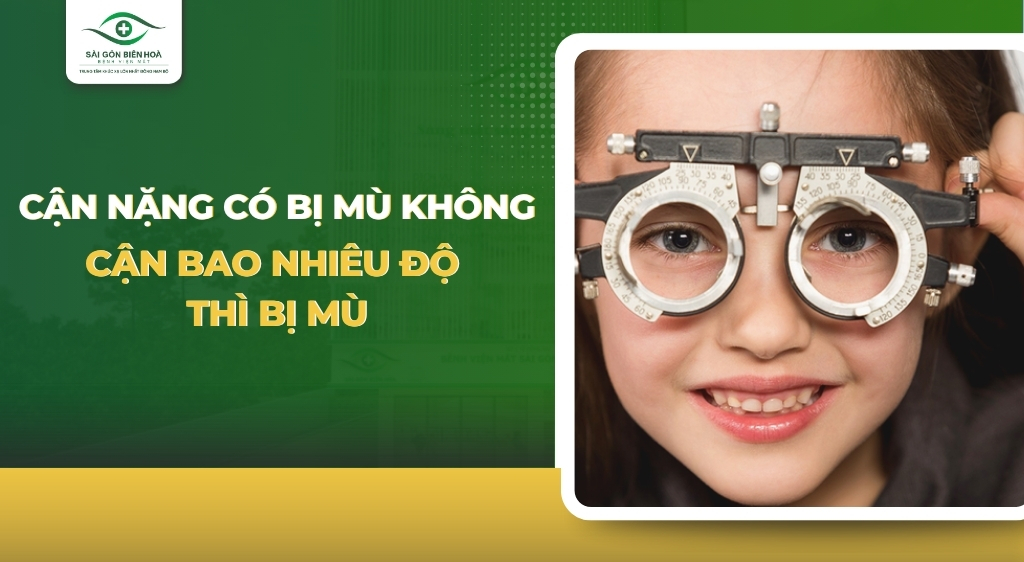 Cận nặng có bị mù không