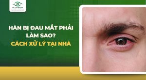 Hàn bị đau mắt phải làm sao