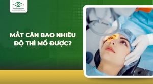 Mắt cận bao nhiêu độ thì mổ được