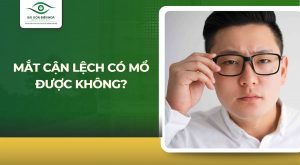 Mắt cận lệch có mổ được không?