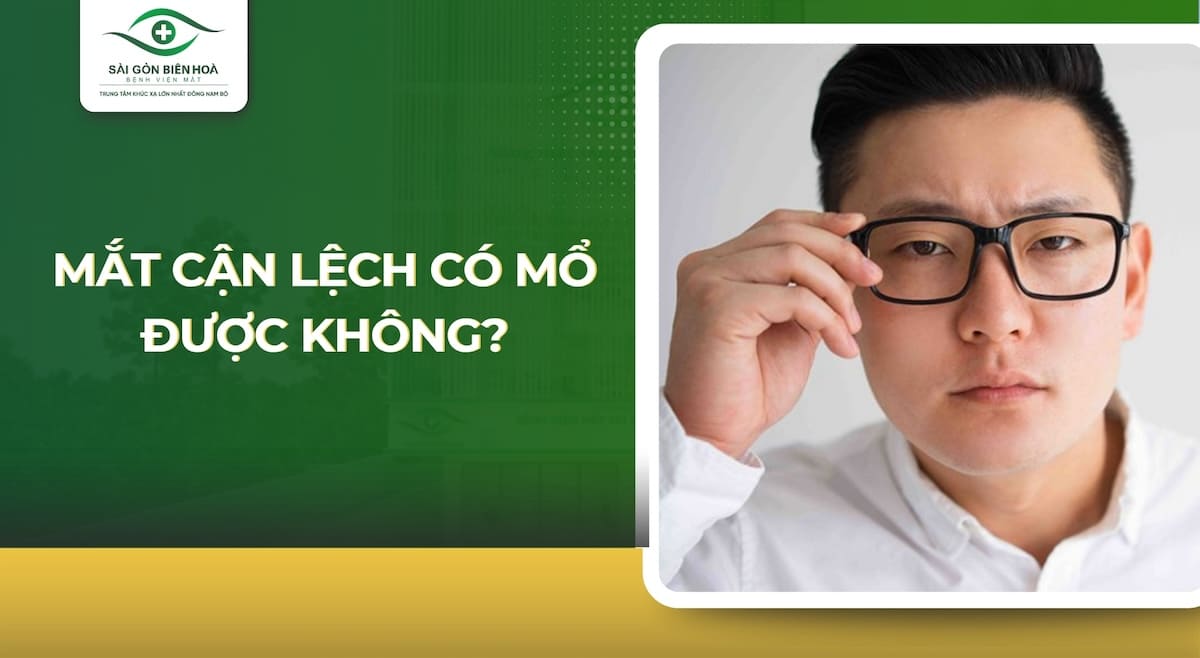 Mắt cận lệch có mổ được không?