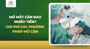 Mổ mắt cận bao nhiêu tiền?