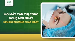 Mổ mắt cận thị công nghệ mới nhất