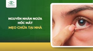 nguyên nhân ngứa hốc mắt