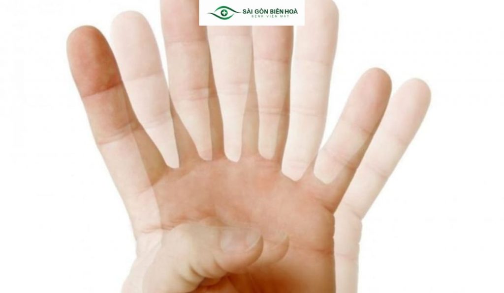 Ở một số trường hợp người bệnh cí thể nhìn một vật ra hai vật, 3 vật dù với tầm nhìn rõ