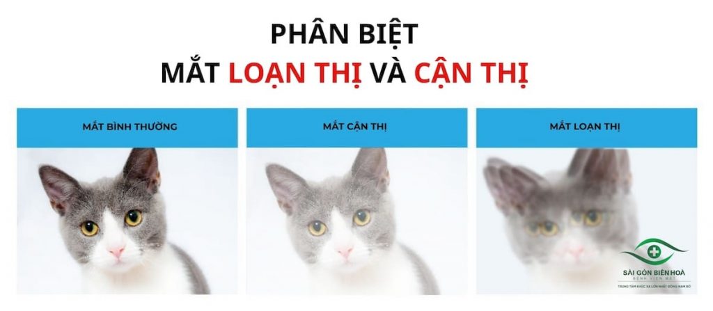 Phân biệt mắt cận thị và loạn thị
