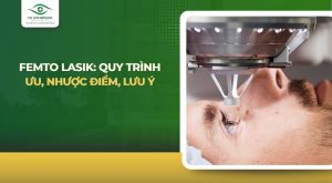 Femto Lasik: Quy trình, Ưu nhược điểm và Lưu ý