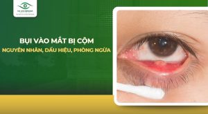 Bụi vào mắt bị cộm