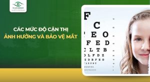Các mức độ cận thị