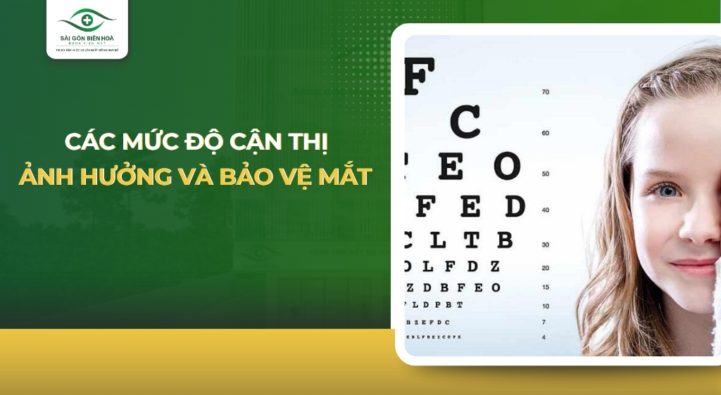 Các mức độ cận thị