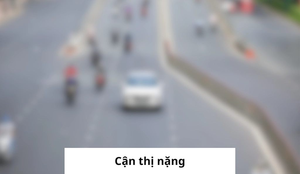 Cận thị nặng