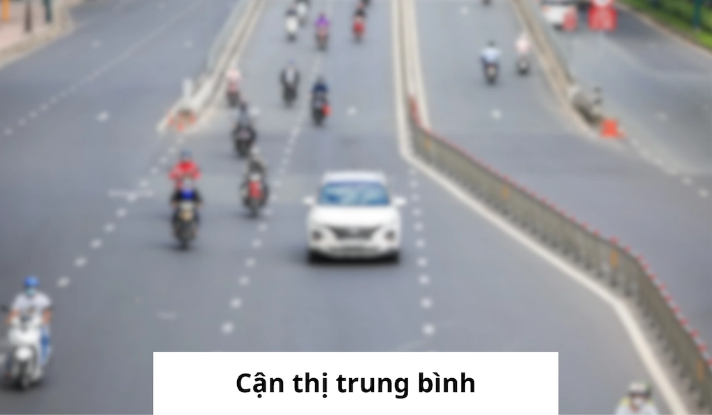 Cận thị trung bình