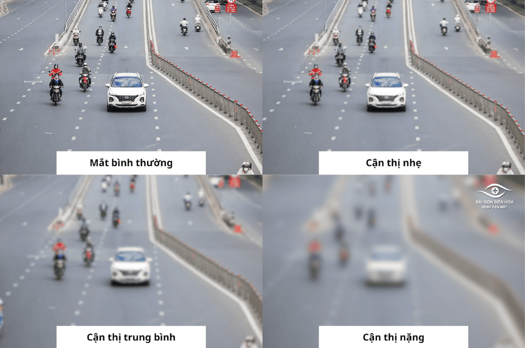 Hình ảnh người cận thị nhìn thấy